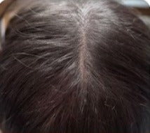 After 6 Weeks