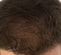 After 3 Months